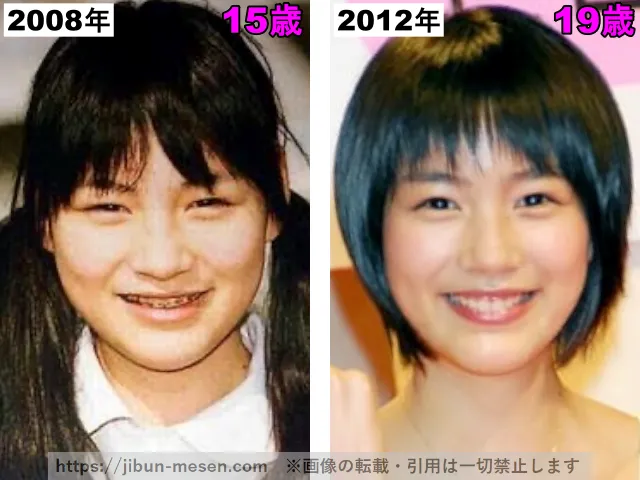 能年玲奈（のん）の鼻の整形検証2008年〜2012年