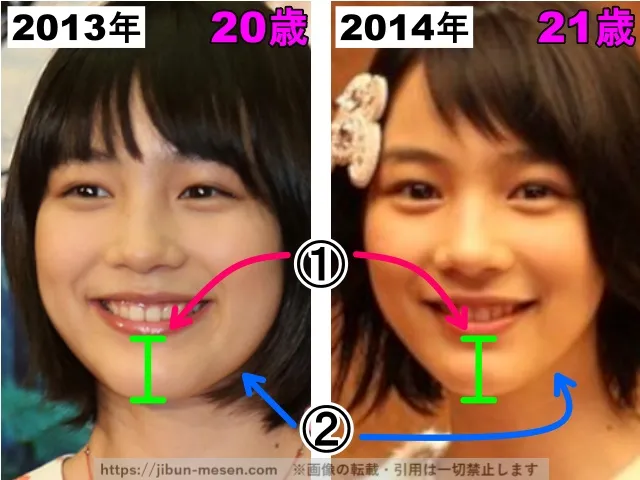 能年玲奈(のん)の輪郭の整形検証2013年〜2014年(拡大)