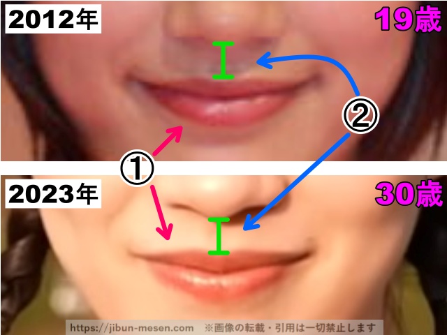 能年玲奈（のん）の口の整形検証2012年〜2023年（拡大）の画像