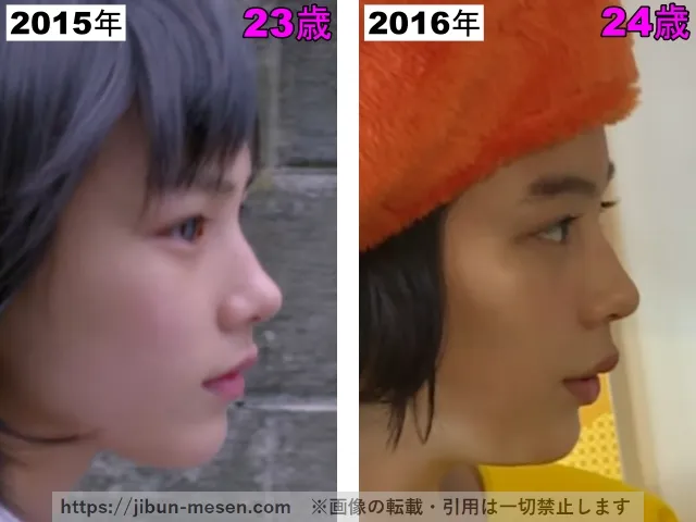 能年玲奈(のん)の顎の比較検証2015年〜2016年