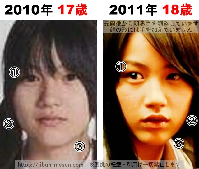 能年玲奈(のん)の整形検証2010年〜2011年