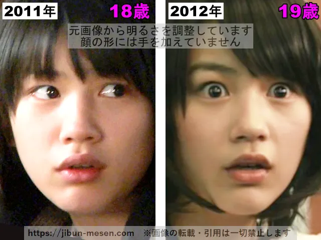 能年玲奈(のん)の口の整形検証2011年〜2012年