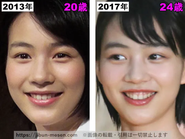 能年玲奈（のん）の鼻の整形検証2013年〜2017年