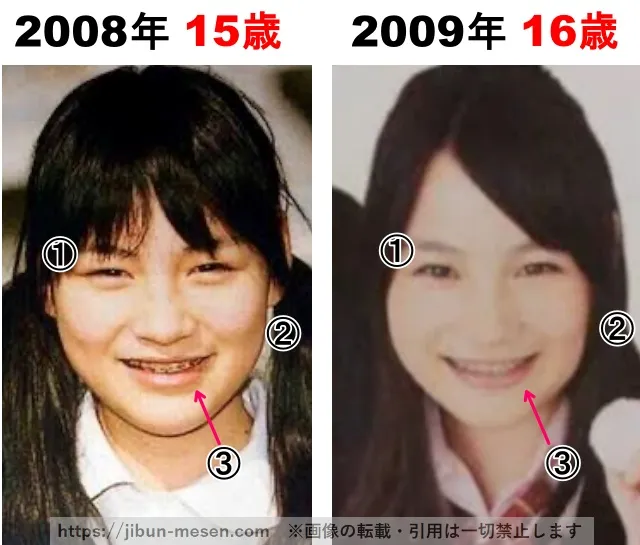 能年玲奈(のん)の整形検証2008年〜2009年