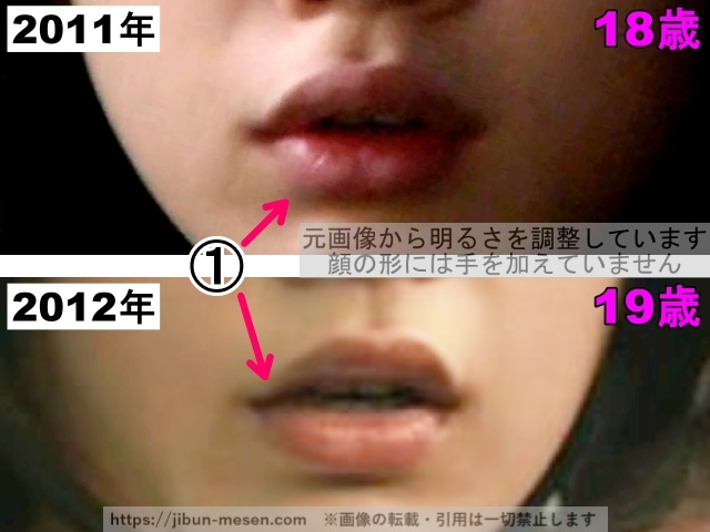 能年玲奈（のん）の口の整形検証2011年〜2012年（拡大）