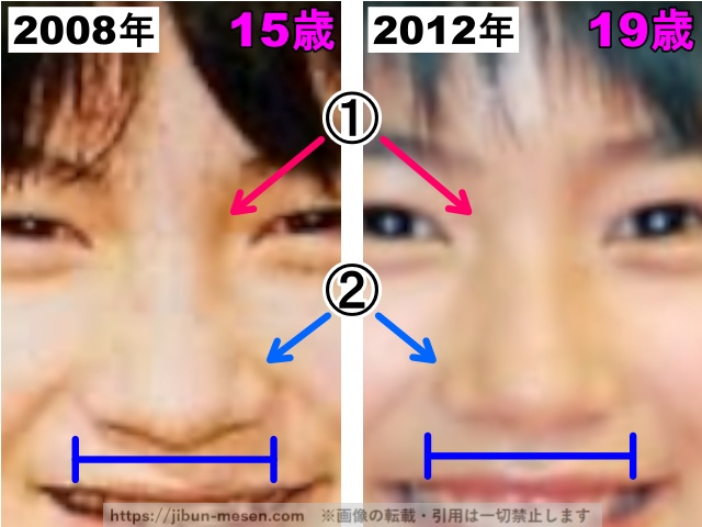 能年玲奈（のん）の鼻の整形検証2008年〜2012年（拡大）の画像