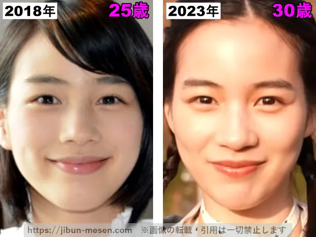 能年玲奈（のん）の鼻の整形検証2018年〜2023年