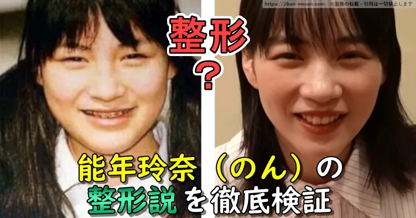 能年玲奈（のん）の整形説を徹底検証