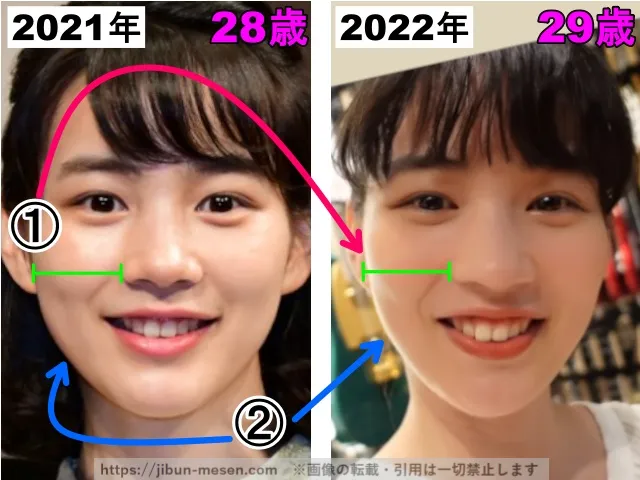 能年玲奈(のん)の輪郭の整形検証2021年〜2022年(拡大)