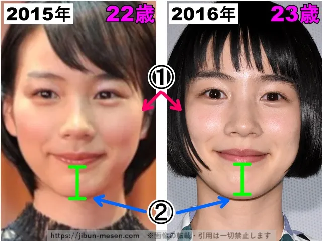 能年玲奈(のん)の輪郭の整形検証2015年〜2016年(拡大)