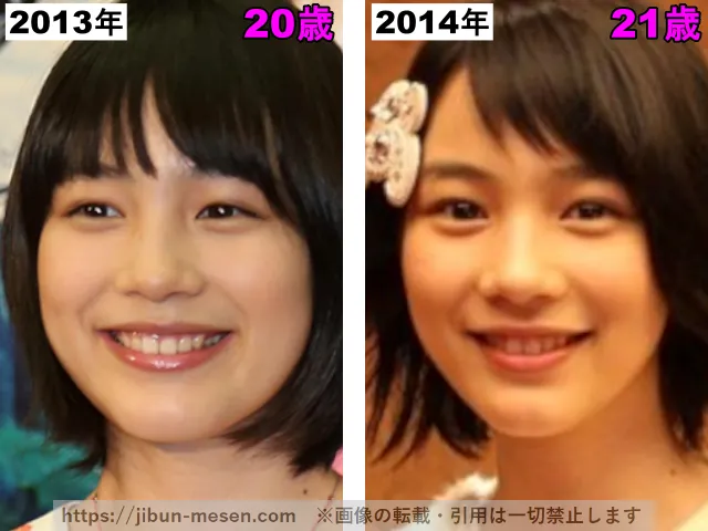 能年玲奈(のん)の輪郭の整形検証2013年〜2014年