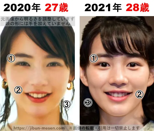 能年玲奈(のん)の整形検証2020年〜2021年