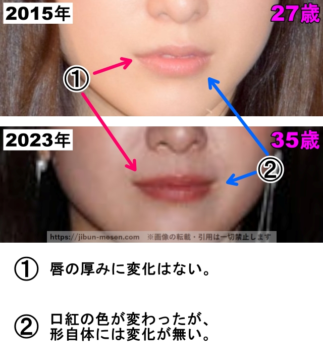 吉高由里子の口の整形検証2015年〜2023年（拡大）の画像