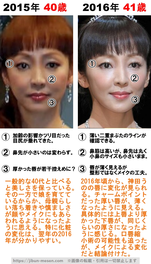 神田うのの整形検証2015年〜2016年の画像