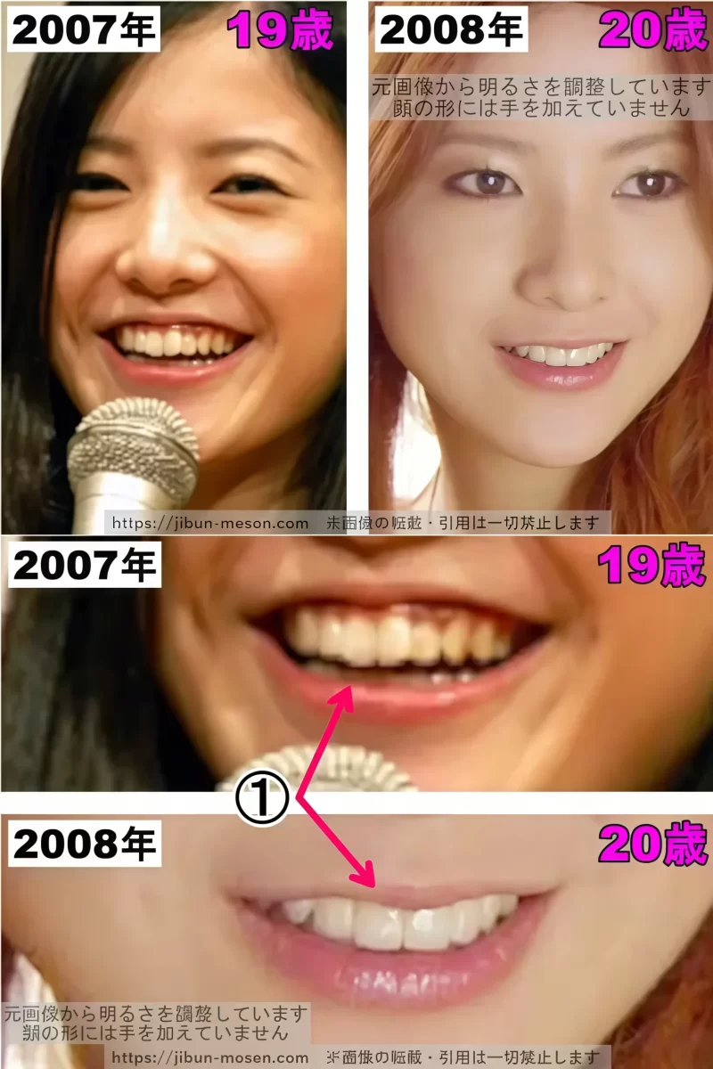 吉高由里子の口の整形検証2007年〜2008年の画像