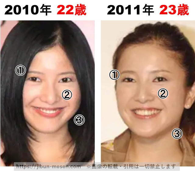 吉高由里子の整形検証2010年〜2011年の画像