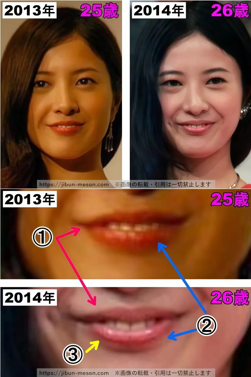 吉高由里子の口の整形検証2013年〜2014年の画像