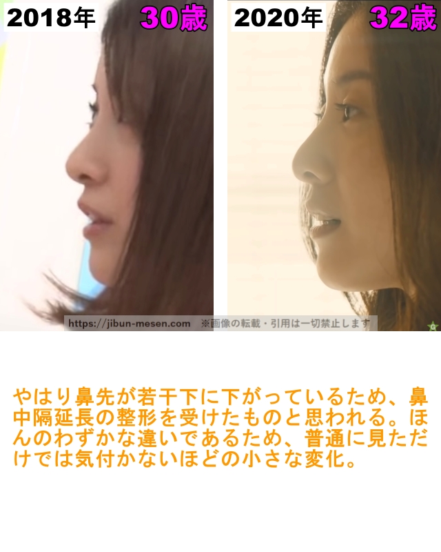 吉高由里子の鼻の整形検証2018年〜2020年（横顔）の画像