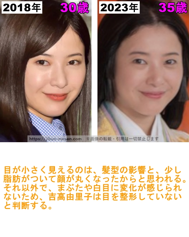 吉高由里子の目の整形検証2018年〜2023年の画像