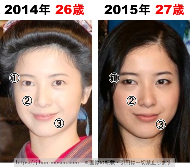 吉高由里子の整形検証2014年〜2015年の画像