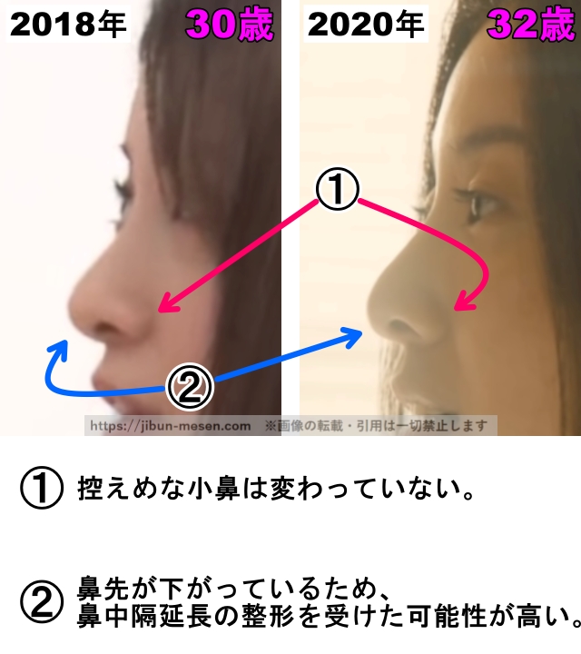 吉高由里子の鼻の整形検証2018年〜2020年（横顔・拡大）の画像