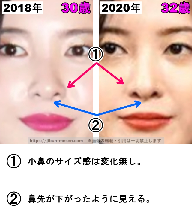 吉高由里子の鼻の整形検証2018年〜2020年（拡大）の画像