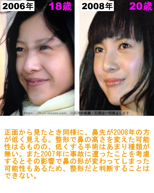 吉高由里子の鼻の整形検証2006年～2008年（横顔）の画像