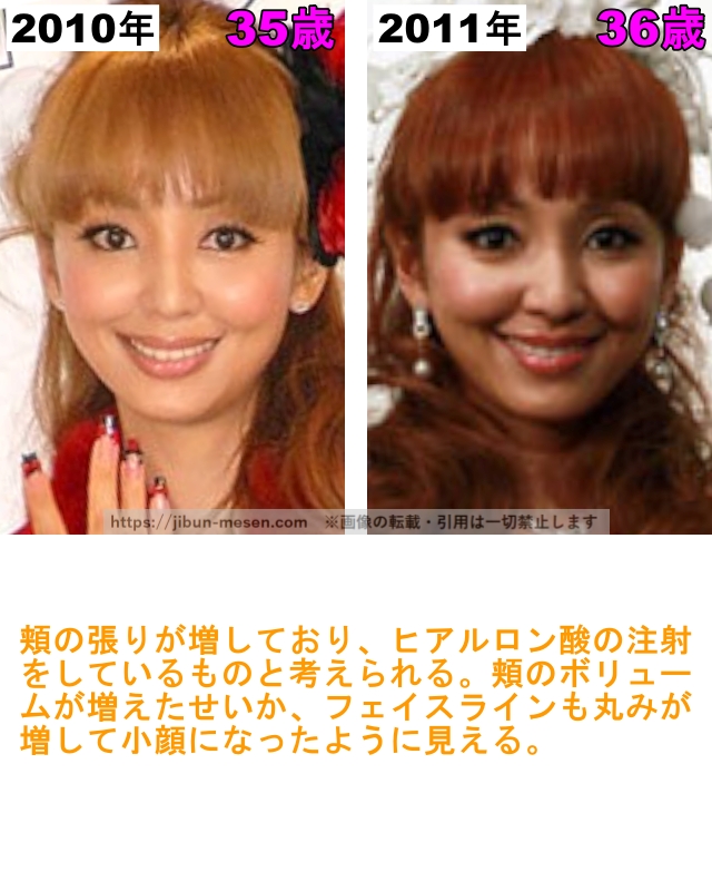 神田うのの肌の整形検証2010年〜2011年の画像