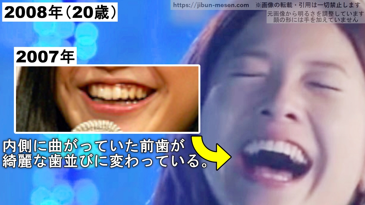 吉高由里子の歯並びの変化の画像