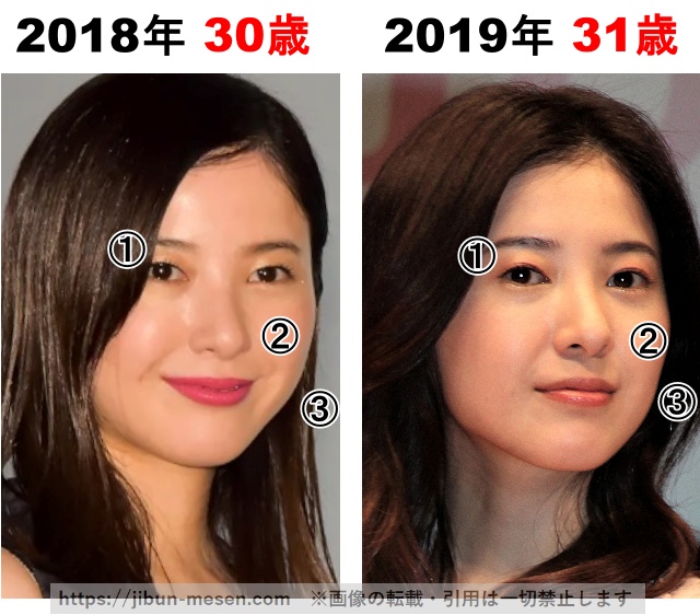 吉高由里子の整形検証2018年〜2019年の画像