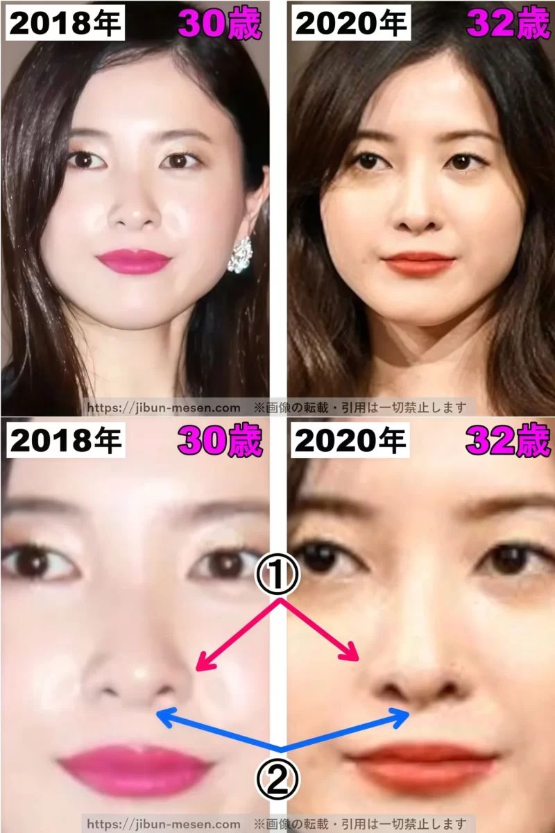 吉高由里子の鼻の整形検証2018年〜2020年の画像