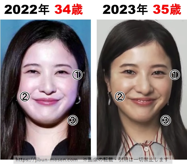吉高由里子の整形検証2022年〜2023年の画像