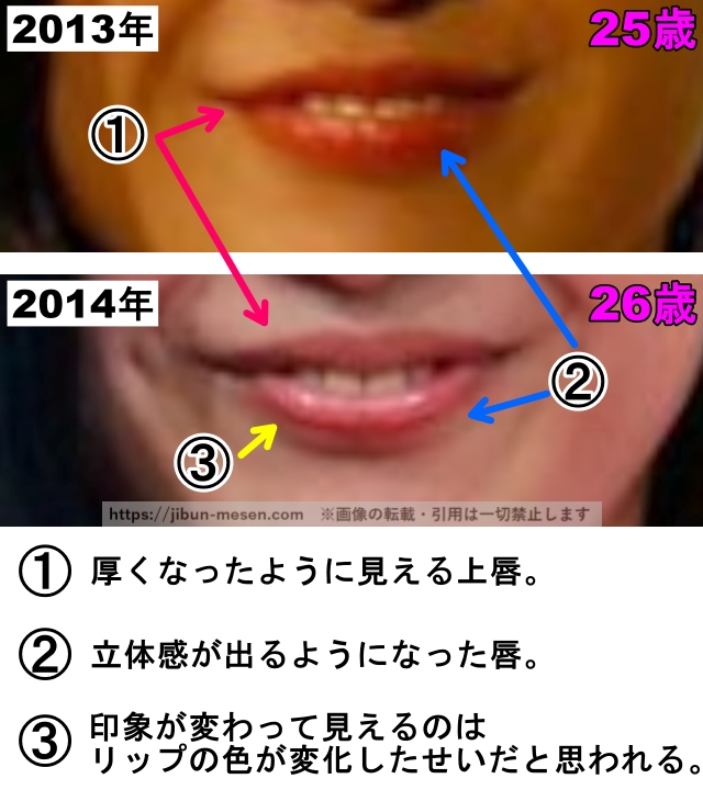 吉高由里子の口の整形検証2013年〜2014年（拡大）の画像