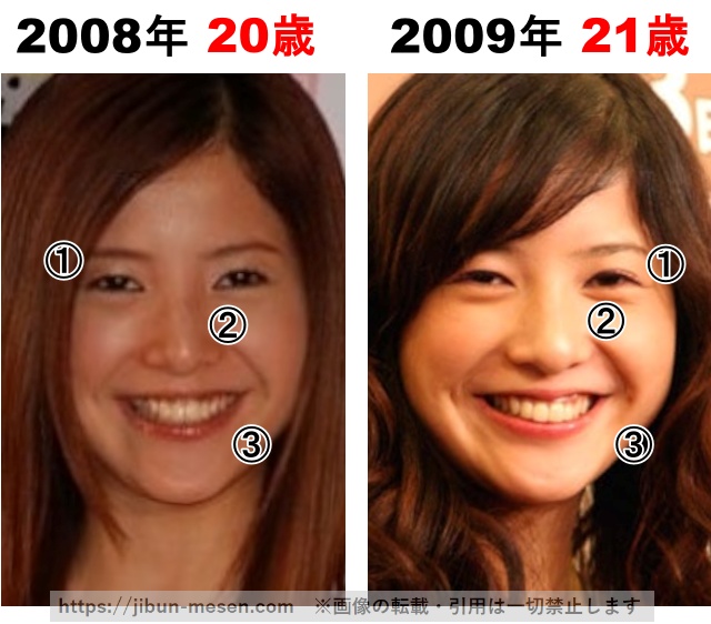 吉高由里子の整形検証2008年〜2009年の画像