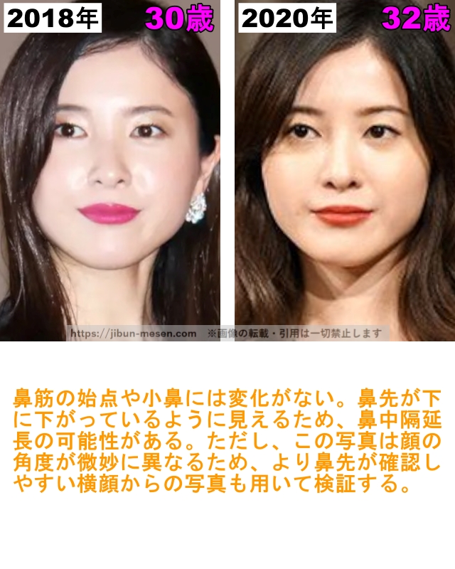 吉高由里子の鼻の整形検証2018年〜2020年の画像