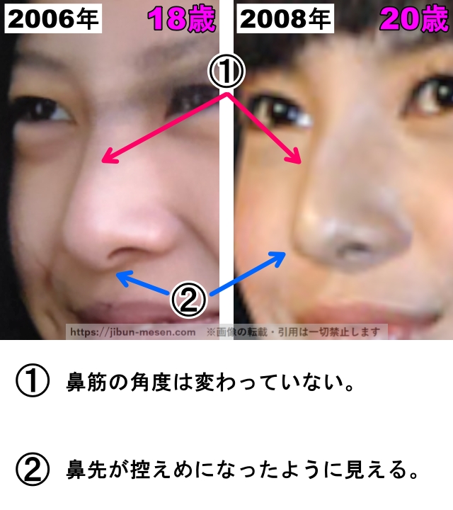 吉高由里子の鼻の整形検証2006年〜2008年（横顔・拡大）の画像