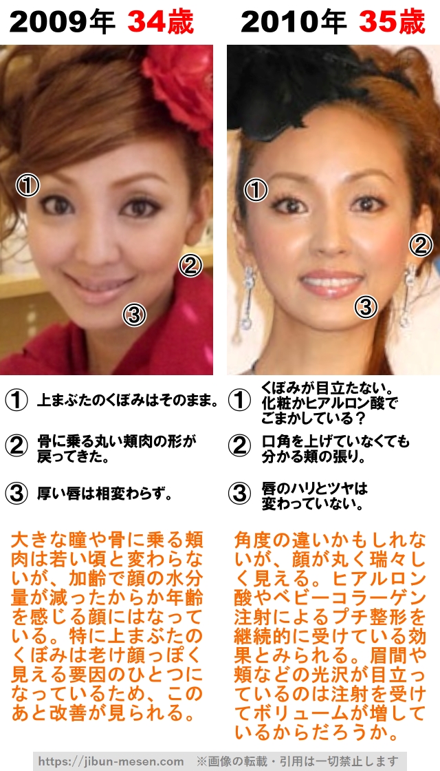 神田うのの整形検証2009年〜2010年の画像