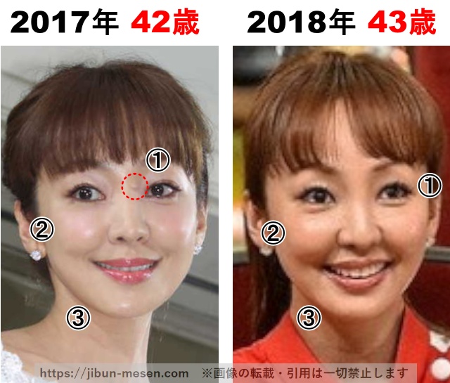 神田うのの整形検証2017年〜2018年の画像