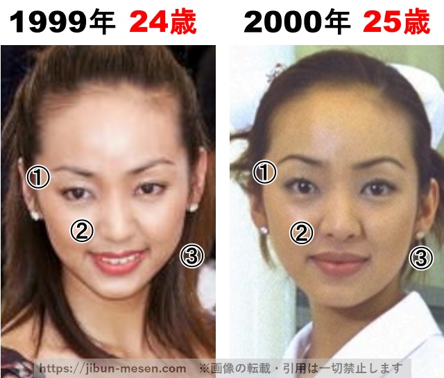 神田うのの整形検証1999年〜2000年の画像