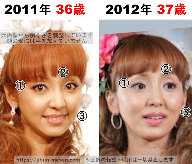 神田うのの整形検証2011年〜2012年の画像