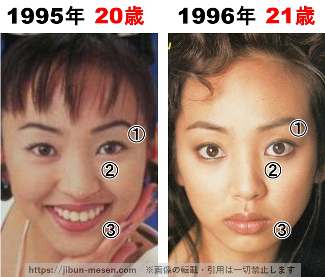 神田うのの整形検証1995年〜1996年の画像