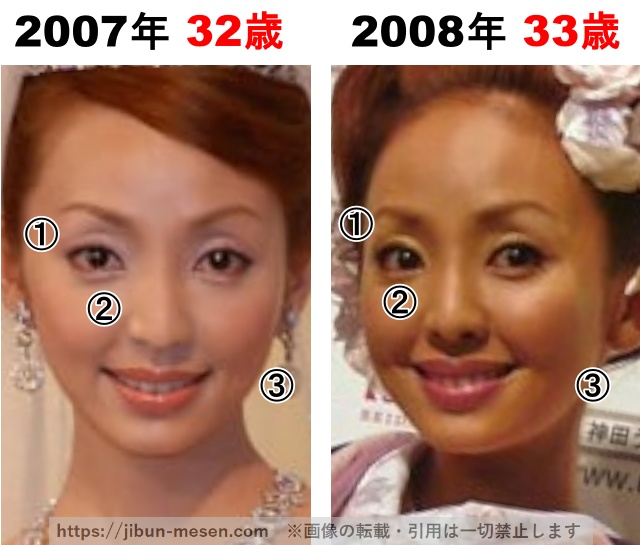 神田うのの整形検証2007年〜2008年の画像
