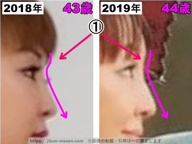 神田うのの鼻の整形検証2018〜2019年（横顔）の画像