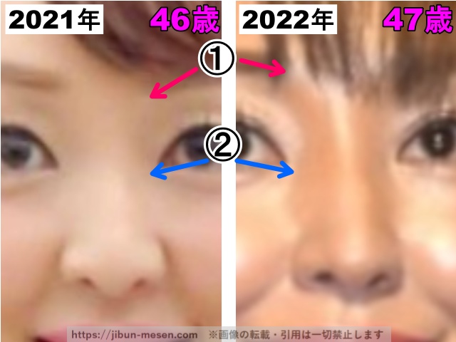 神田うのの鼻の整形検証2021年〜2022年（拡大）の画像