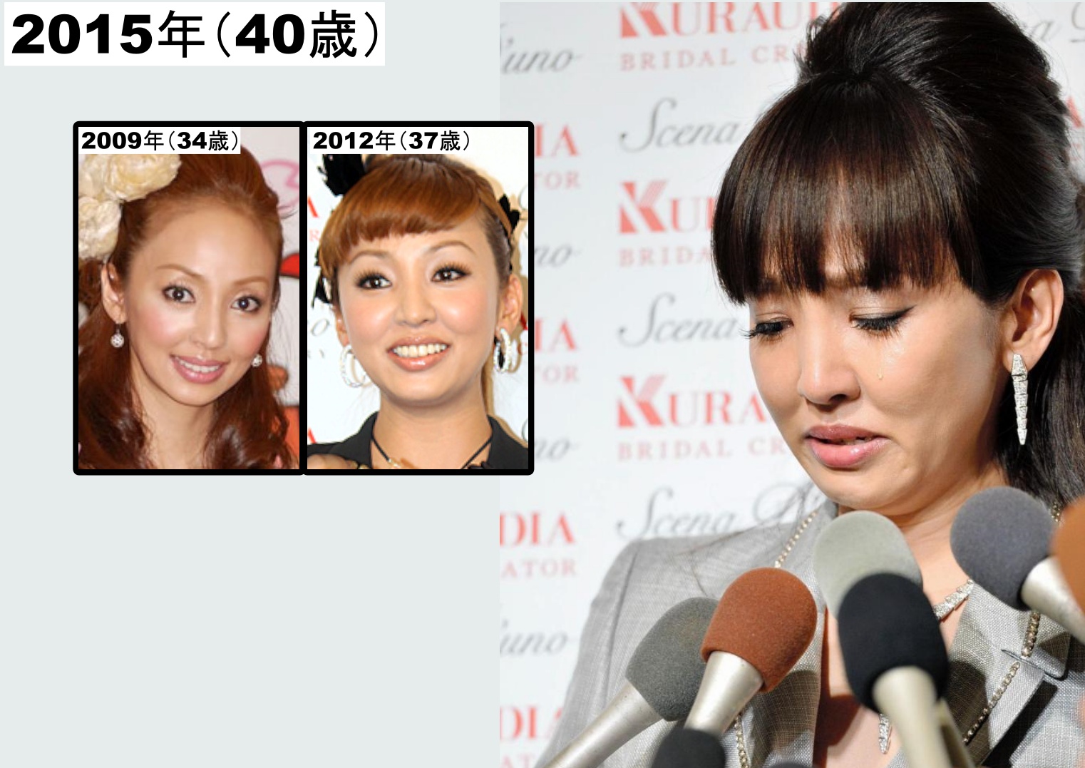 ほうれい線が消えた神田うのの画像