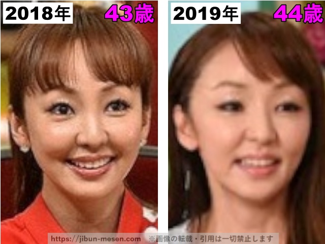 神田うのの鼻の整形検証2018年〜2019年の画像