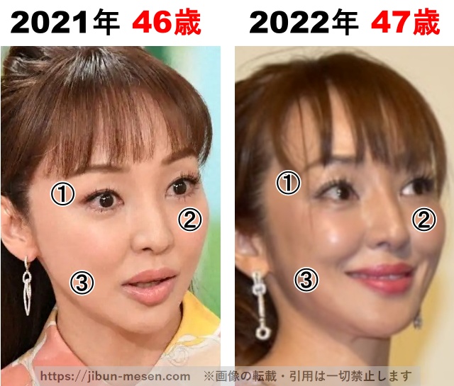 神田うのの整形検証2021年〜2022年の画像