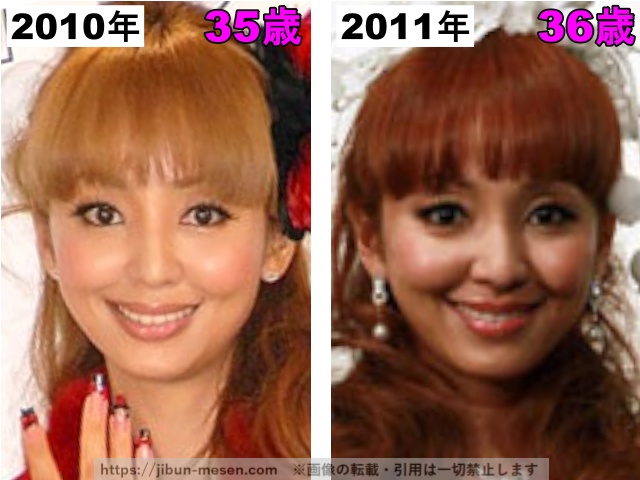 神田うのの肌の整形検証2010年〜2011年の画像