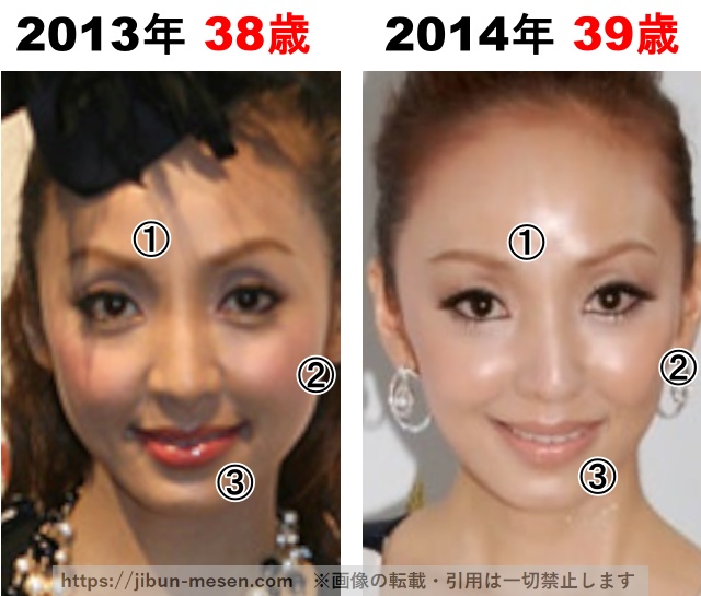神田うのの整形検証2013年〜2014年の画像