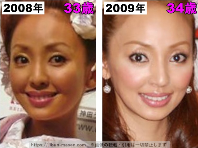 神田うのの鼻の整形検証2008〜2009年の画像